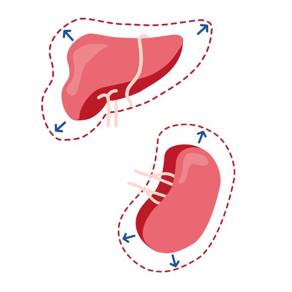 Vergößerte Leber und Milz bei LAL-D