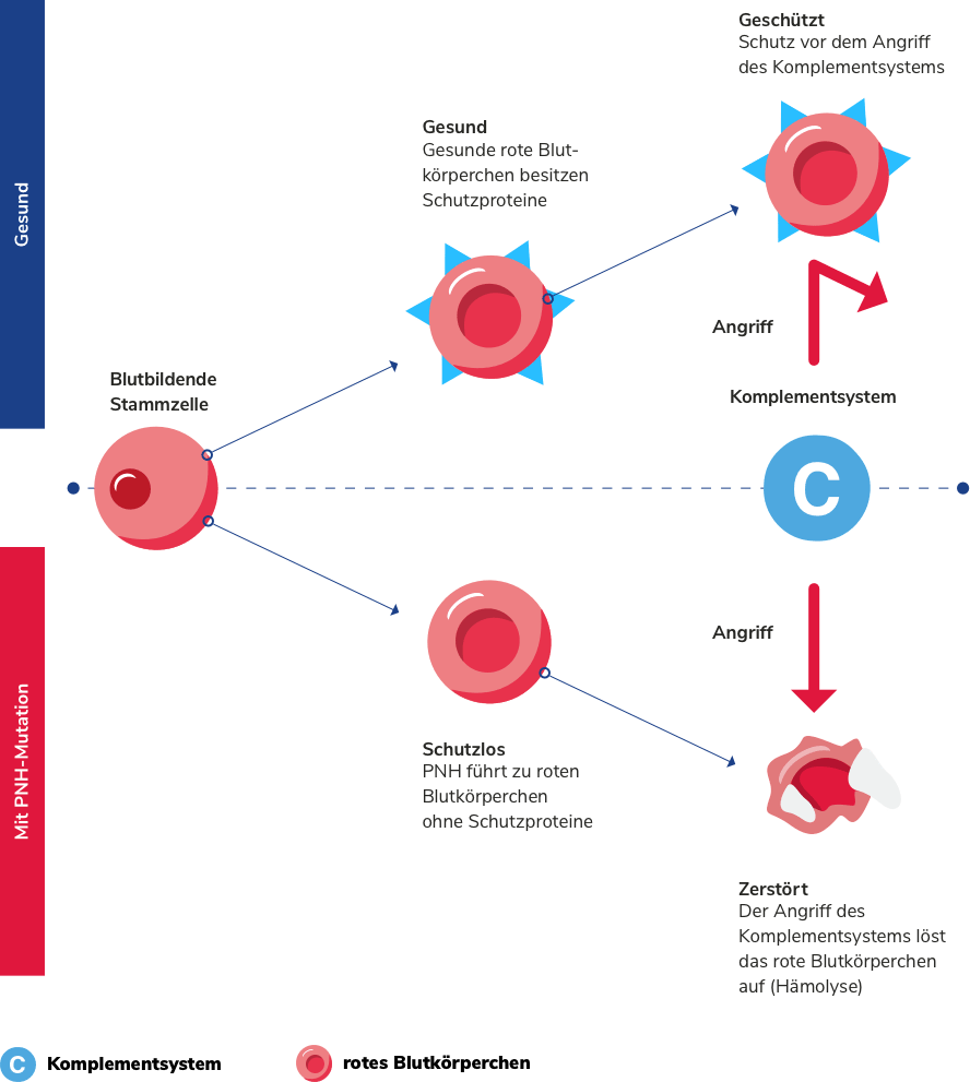 Paroxysmale nächtliche Hämoglobinurie (PNH)Alexion